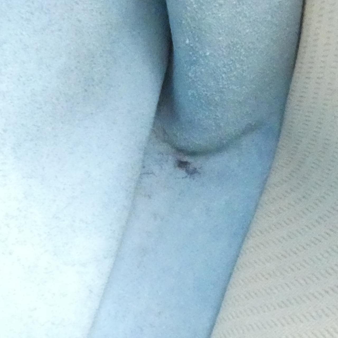 エルメス ヴェスパ PM 041108CK ショルダーバッグ