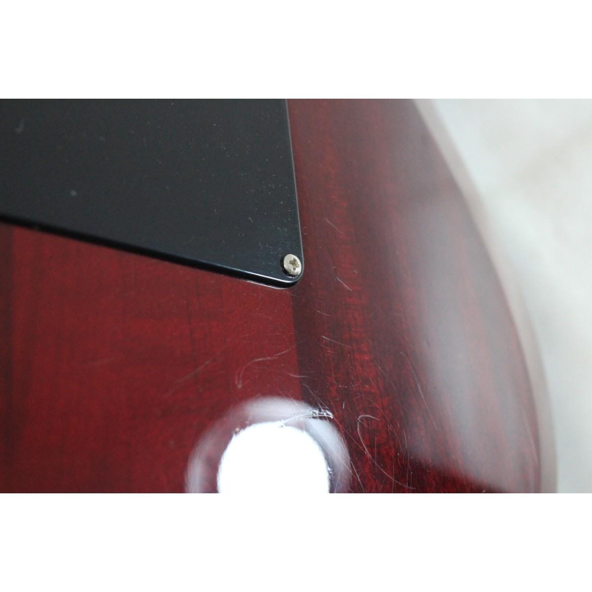 ＥＳＰ　ＢＯＴＴＯＭ　ＬＩＮＥ　ＧＴ