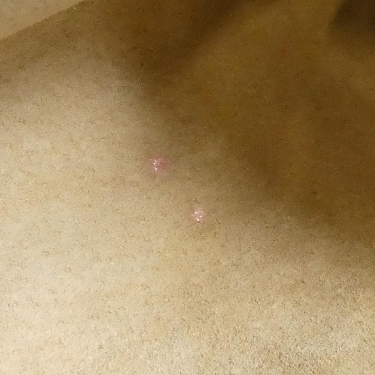 フェンディ 8BT085 00VDU058 バッグ